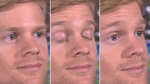 skynews-drew-scanlon-blinking-white-guy_4786055