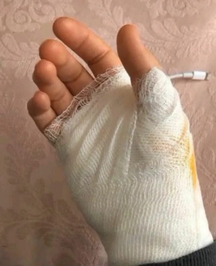 i (1)